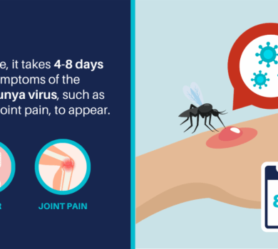 chikungunya virus